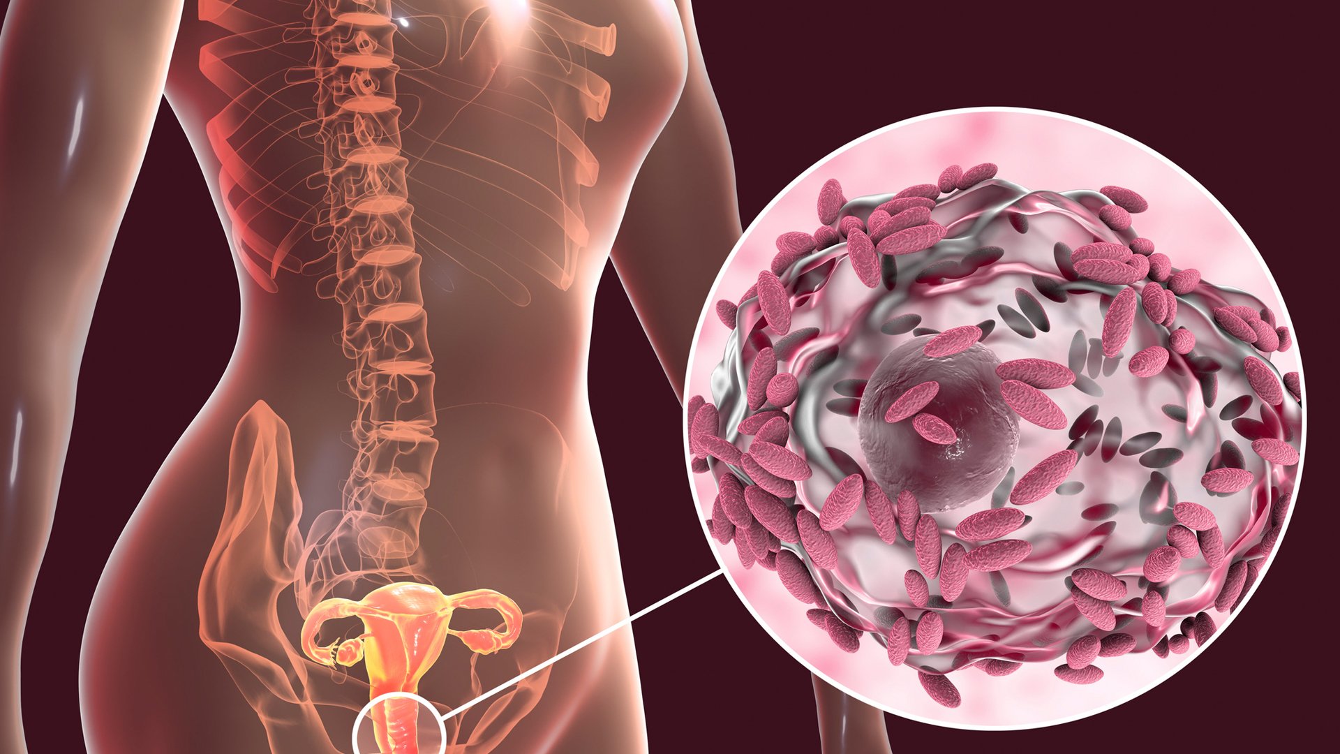 Diagram of female reproductive system with magnified biofilm view